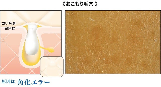 騾｣霈臥ｬｬ6蝗樔ｽｿ逕ｨ逕ｻ蜒・4