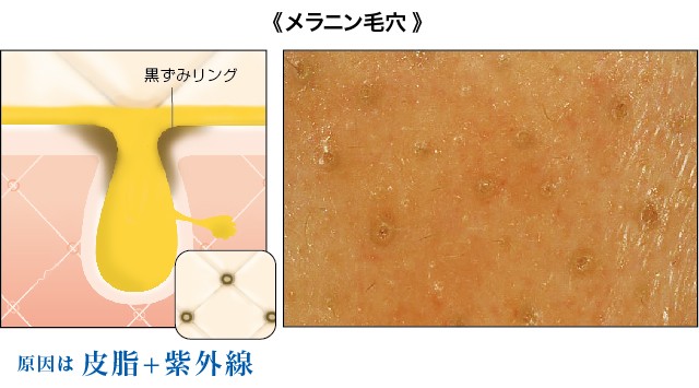 騾｣霈臥ｬｬ6蝗樔ｽｿ逕ｨ逕ｻ蜒・3