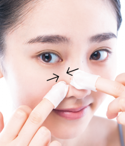 ニキビ部分は横にこすらずバウンド拭き