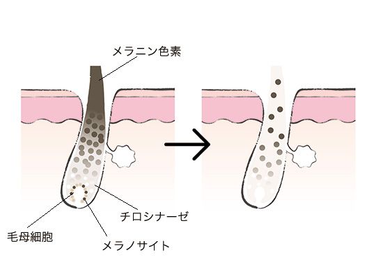 ストレスで白髪になるって本当 メカニズム 原因を知って即対策 美的 Com