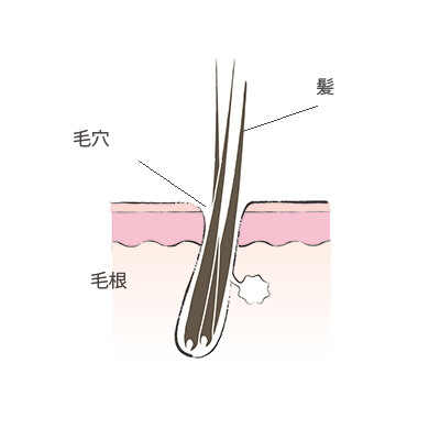 白髪を抜いてもいいことナシ