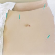 腸活の新たな注目メソッド登場!   美腸鍼と＜腸育＞サプリで、巡るからだを即実感