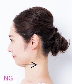 首のシワの予防法&美容医療