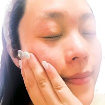 “メスを使わない美容医療”とまで言われる「ヒト幹細胞」コスメって？