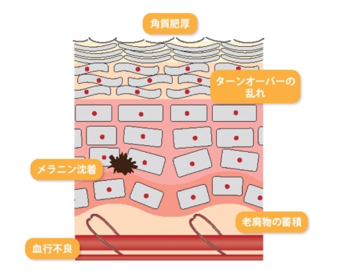 かゆみを伴う肌トラブル！血行不良が招くニキビや肌荒れ