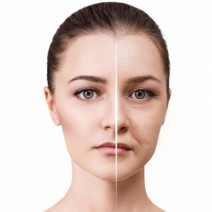 秋はたるみが加速！皮膚科医が教える簡単「ブルドッグ顔」改善ケア
