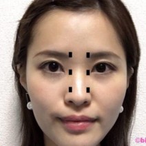 長年同じ眉でしょ!? 「顔の違和感を生む」NG眉メイクの解決法5つ