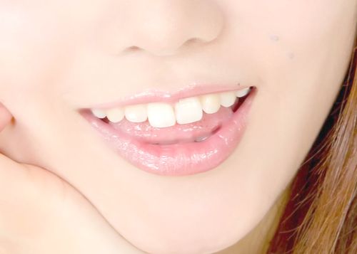 飲み物で歯が溶ける恐怖！健康な歯のためにやってはいけないこと