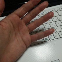 指輪が似合わない…ごっつい「ムクムク指」をホッソリ華奢にする術