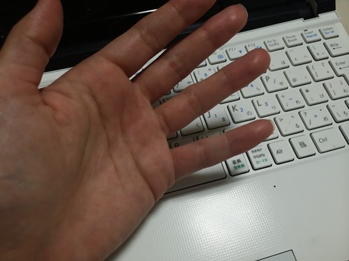 指輪が似合わない…ごっつい「ムクムク指」をホッソリ華奢にする術