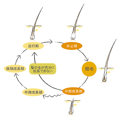 健康なヘアサイクルと乱れたヘアサイクル