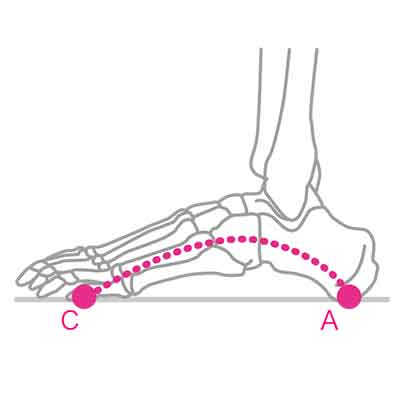 健康な足には3つのアーチがある