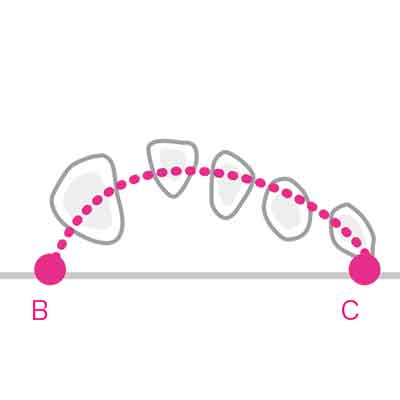 健康な足には3つのアーチがある