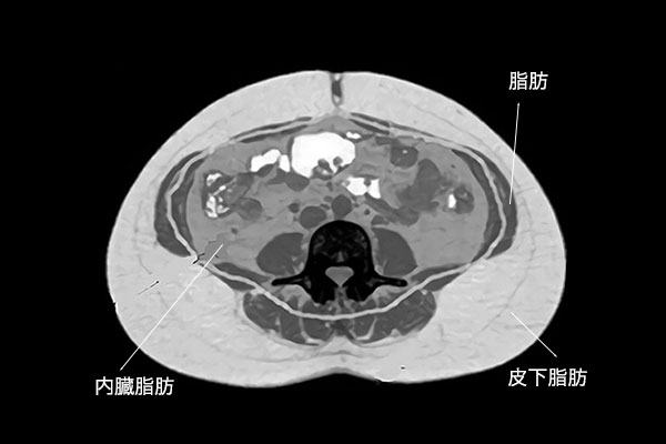 腹 回り 内臓 脂肪 落とす 男