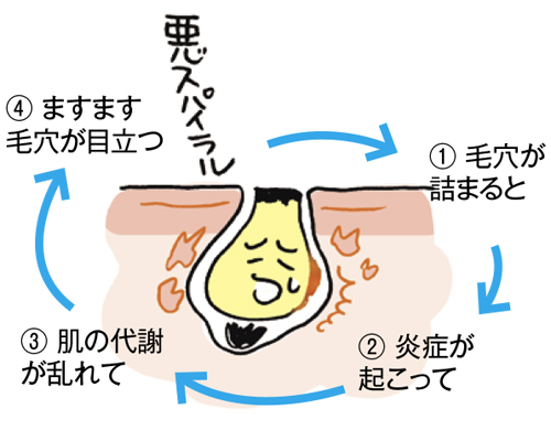 スキンケア 毛穴詰まり