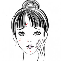 黄ニキビの治し方は？医師・美容のプロによる【対処法まとめ】
