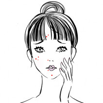 ニキビのできる場所には意味があった！ おでこ、頬、小鼻、口元…できやすい原因やニキビの種類を女医が解説！