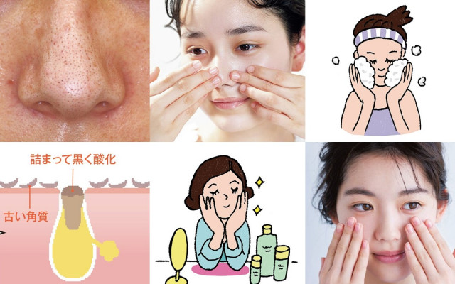 皮膚科医に聞いた メラニン毛穴 原因 と Ng行為 と ケア方法 美的 Com
