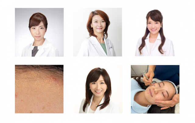 皮膚科医に訊いた 初期段階 白ニキビ の原因と治し方 美的 Com