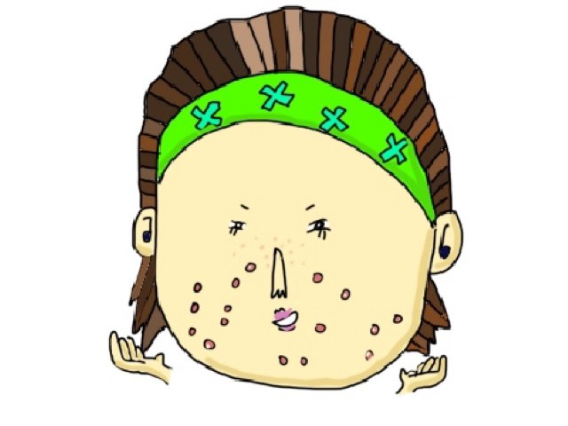 【原因・悩み別】皮膚科医に訊いた、大人ニキビの対策まとめ