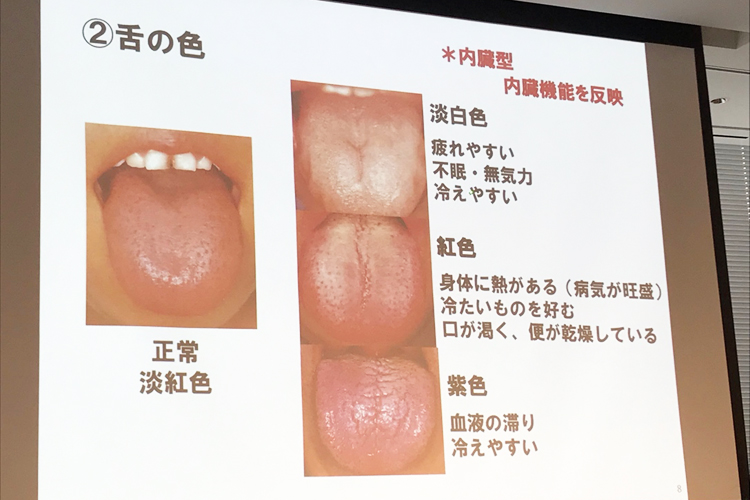 冷えの原因は大きく分けて3タイプ