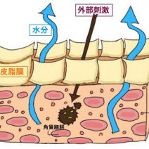 肌荒れの「原因８つ」と「改善スキンケア術５つ」