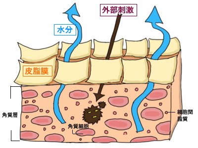 肌荒れの「原因８つ」と「改善スキンケア術５つ」