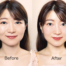 美容矯正で小顔に！美的クラブが超人気サロンの小顔美容矯正＆酵素オイルフェイシャルを試してみた！