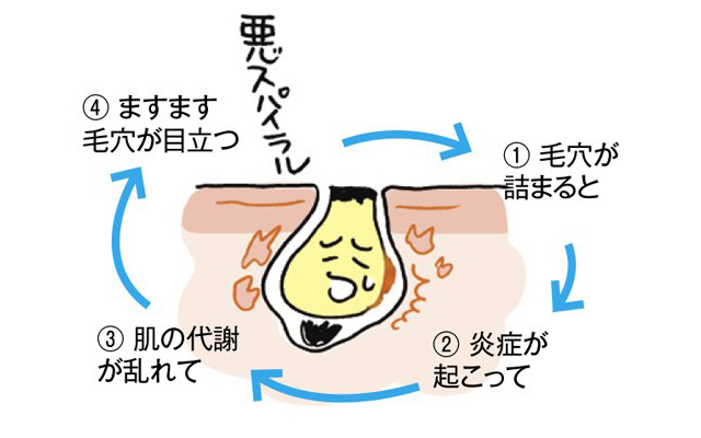 後 白い 洗顔 ポツポツ 毛穴