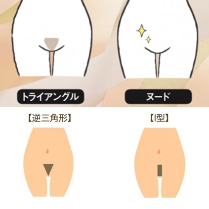 みんなどうしてる？気になる「アンダーヘアの形」１０種類