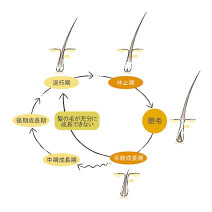 AGAとは？女性にも関係がある？薄毛の原因とサイクル＆治療による対策法