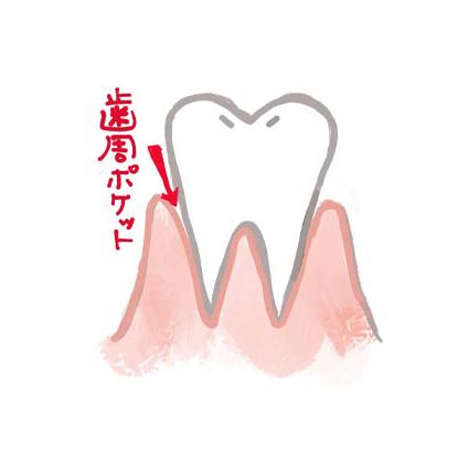 医師が教える歯周病と口臭の関係！歯周病の予防法やおすすめケアアイテムもチェック