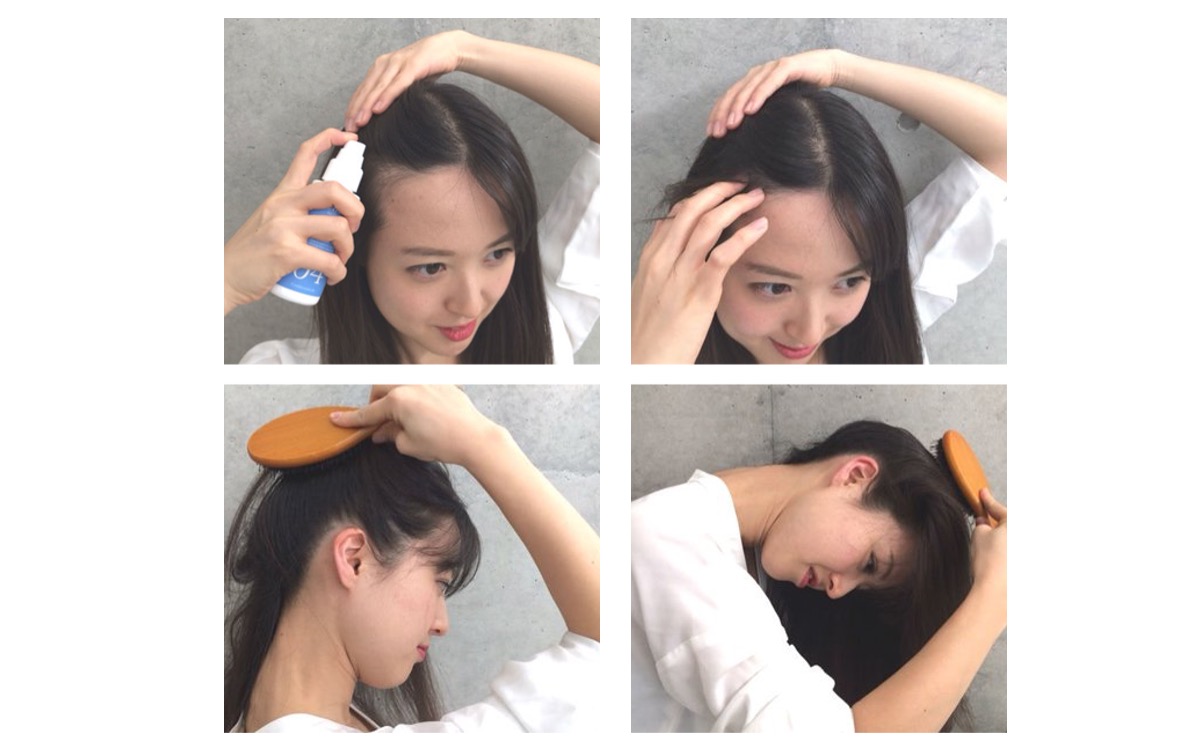 生え際 薄くなってきたら 原因 と 予防 育毛ケア法 美的 Com
