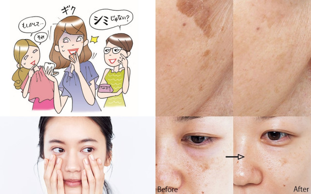 あなたは どのタイプ 肌のシミ 原因３つ と 改善策４つ 美的 Com
