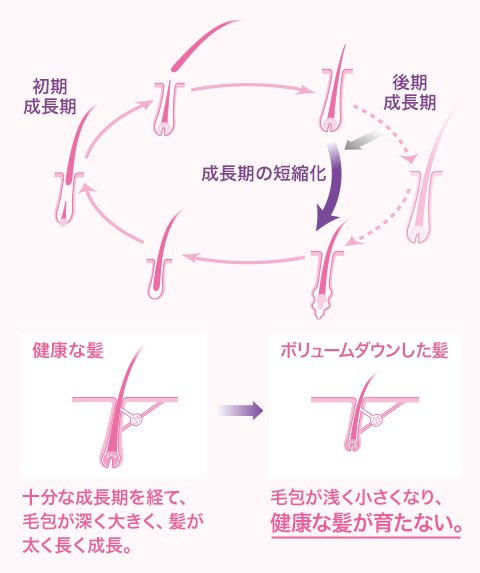 女性の抜け毛のサイクルとは？頭皮を整えるシャンプーを！