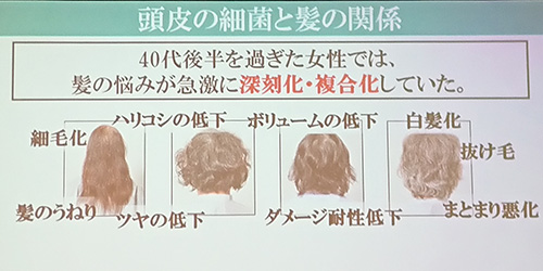 女性の抜け毛 薄毛対策は何をすればいい その原因と対処法をプロが解説 美的 Com