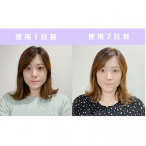 ヤーマン「メディリフト」｜育児や家事をしながら上向きフェイスラインをゲット！／今話題のコスメを本音で使ってみた【7日目編】