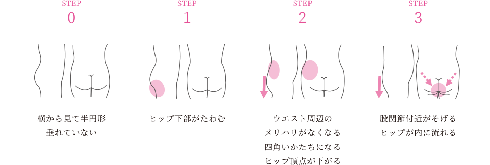 ヒップの揺れを防止したれるのを防ぐガードル