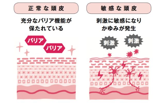 頭皮 かさぶた