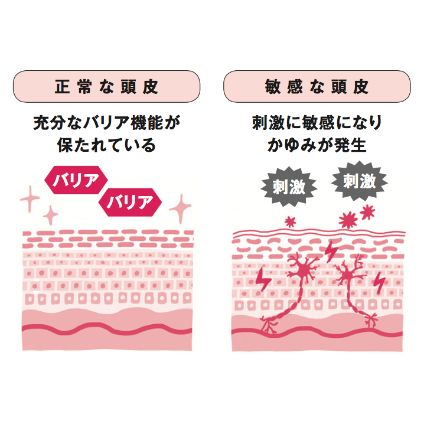 乾燥 フケ かゆみ 頭皮のトラブルを防ぐ 4つの対策 2つの予防法 美的 Com