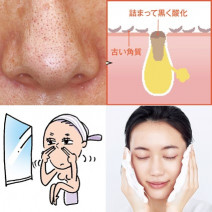 皮膚科医や美のプロに聞く！肌の黒ずみの「５つの原因」と「９つの対策法」