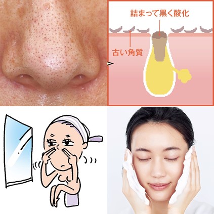 皮膚科医や美のプロに聞く！肌の黒ずみの「５つの原因」と「９つの対策法」