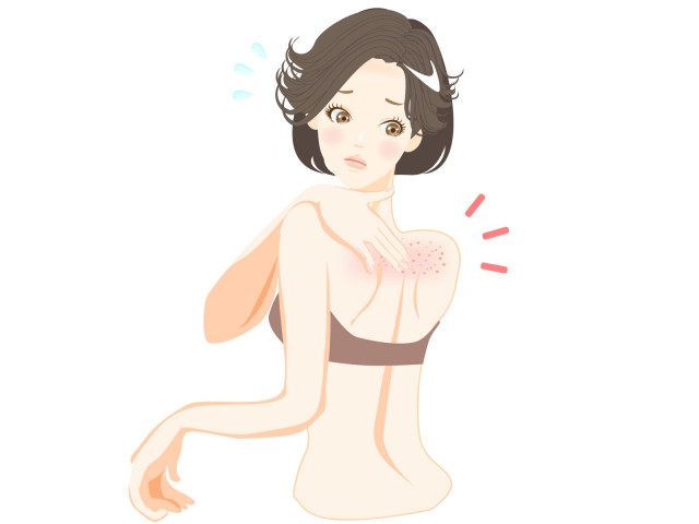 胸ニキビや背中ニキビを跡を残さず治したい 皮膚科医に訊いた できる原因 と 予防 ケア 方法 美的 Com 胸ニキビや背中ニキビを跡を残さず治したい 皮膚科医に訊いた できる原因 と 予防 ケア 方法 美的 Com