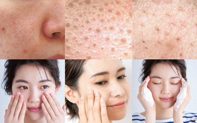 頬の角栓 原因４つ と 対策まとめ 美的 Com