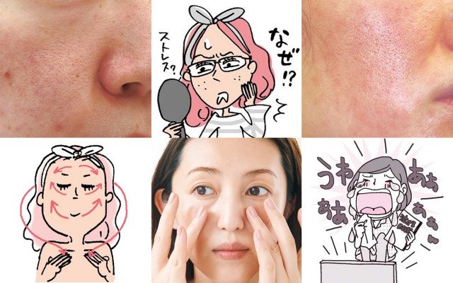ストレス と 肌荒れ の関係性 メカニズム スキンケア対策まとめ 美的 Com ストレス と 肌荒れ の関係性 メカニズム スキンケア対策まとめ 美的 Com