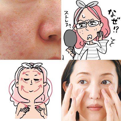 ストレス と 肌荒れ の関係性 メカニズム スキンケア対策まとめ 美的 Com
