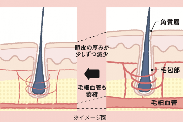 専門家たちに聞いた 髪の毛を増やす 5つの方法 実践して フサフサ健康な美髪へ 美的 Com
