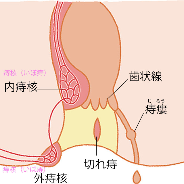 痔の予防や悪化させないために注意すべきことは 専門家医が答える女性の体悩みq A 美的 Com