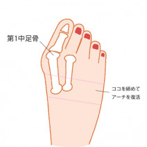 「外反母趾が痛い…」普段からできる対策方法は？専門家医が教えます