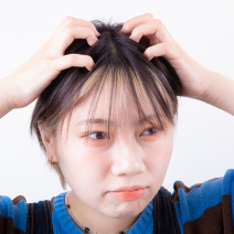 頭皮がかゆくてフケも気になる…原因を見極めて対処せよ！【髪のプロが指南！ヘアのお悩み一問一答vol.16】